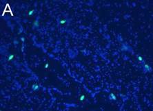 E. coli and Yeast