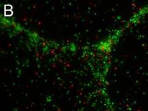 Shigella flexneri viewed after live/dead staining 
