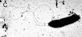 Electron micrograph of Pseudomonas fluorescens